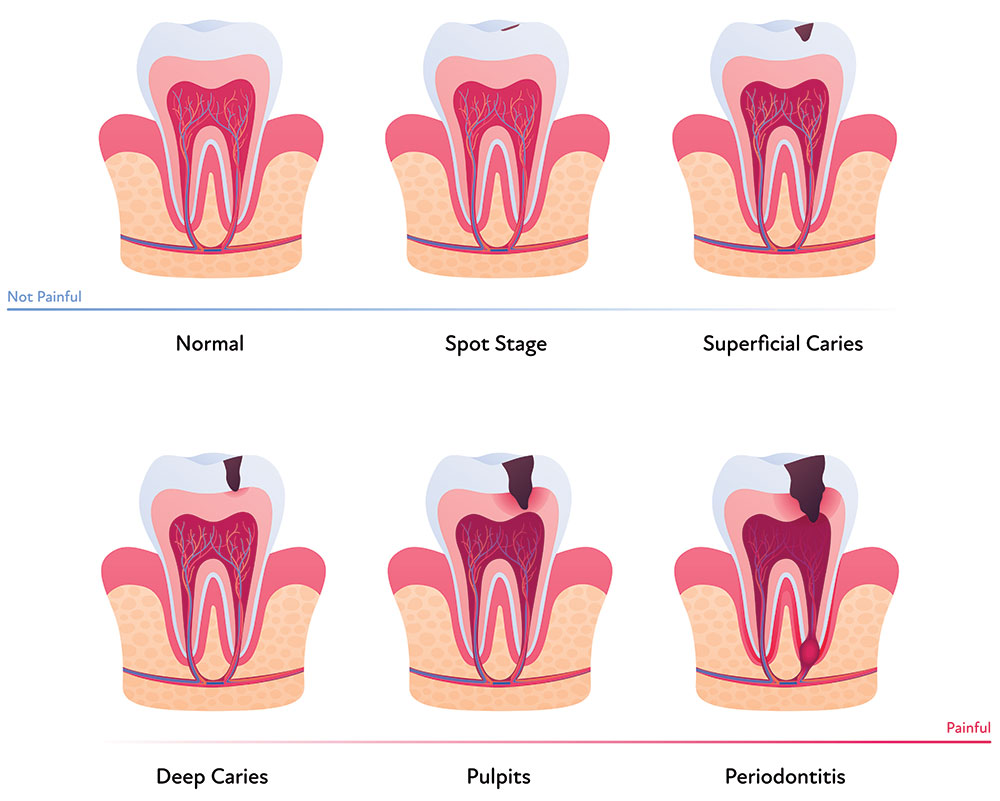 https://www.blackmtndentistry.com/wp-content/uploads/2023/10/2028022121.jpg